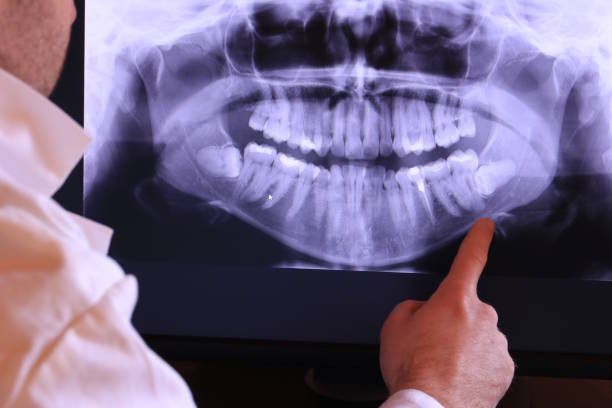 Best Emergency Broken Tooth Repair in Camden, OH